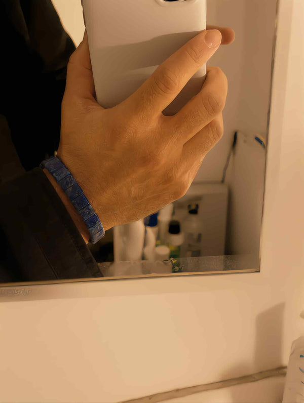 SKALVCO worn